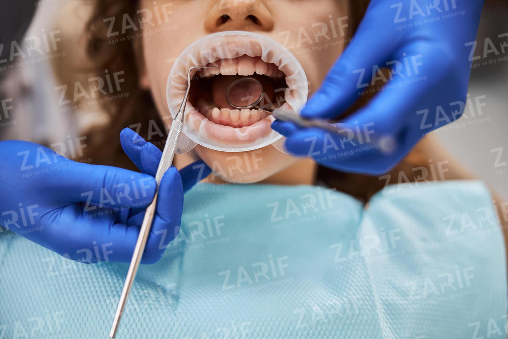 Pedodonti Çocuk Diş Hekimliği Fiyatları